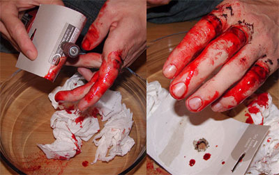 Odstranění tetování - dermabrasion